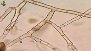 Rhizoctonia solani