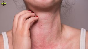 Tác Hại Khi Ăn Dưa Leo Quá Nhiều